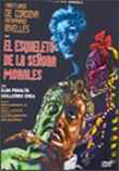 Skeleton of Mrs. Morales